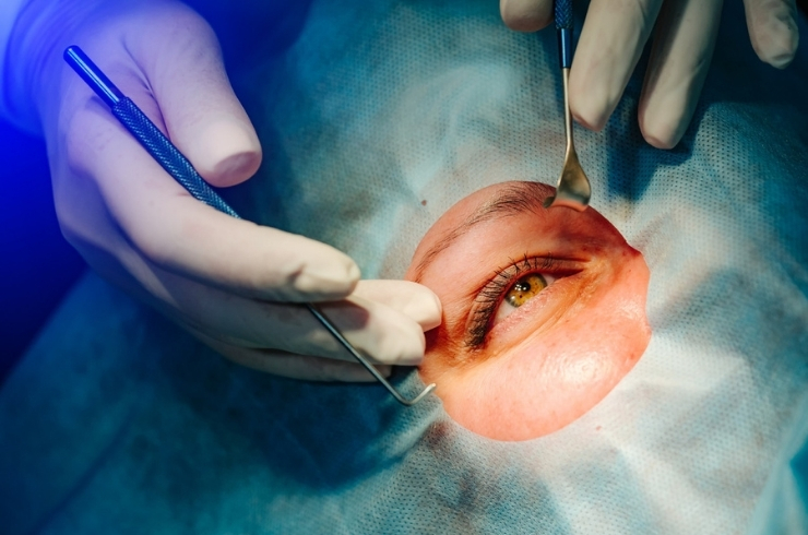 Corneal